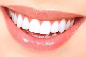 Veneers: The Science of Smile Durability and Long-Term Benefits