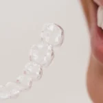 Mastering Oral Hygiene with Invisalign Aligners