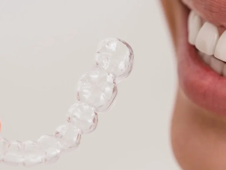 Mastering Oral Hygiene with Invisalign Aligners